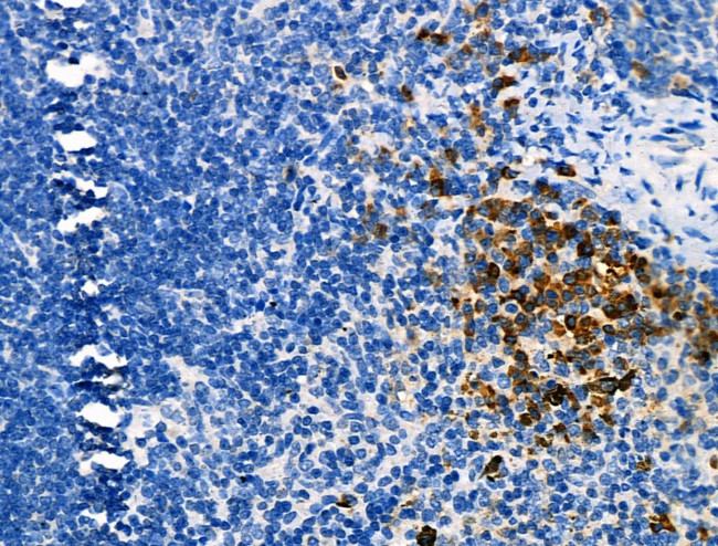 Phospho-JAK3 (Tyr981) Antibody in Immunohistochemistry (Paraffin) (IHC (P))