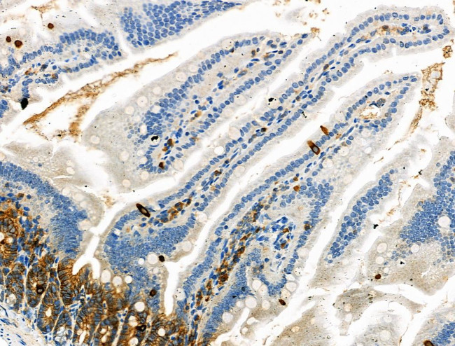 Phospho-JAK3 (Tyr981) Antibody in Immunohistochemistry (Paraffin) (IHC (P))