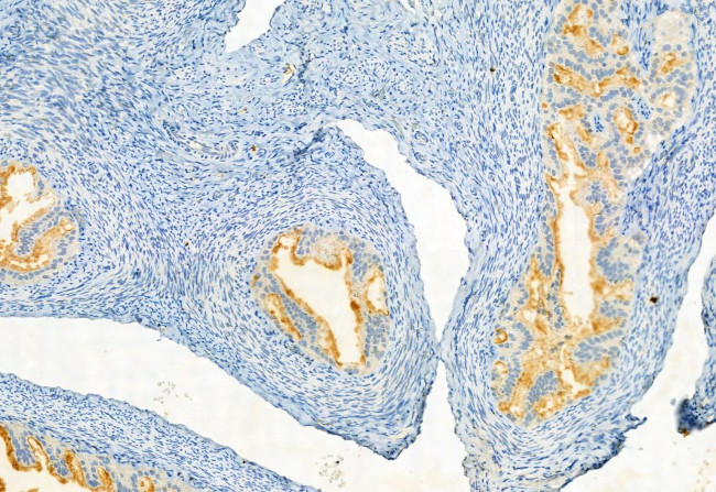 Phospho-JAK3 (Tyr981) Antibody in Immunohistochemistry (Paraffin) (IHC (P))