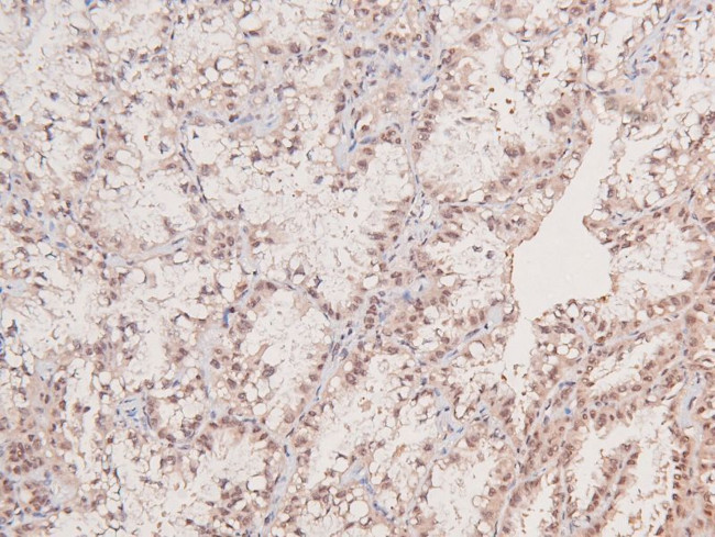 Phospho-JAK3 (Tyr981) Antibody in Immunohistochemistry (Paraffin) (IHC (P))