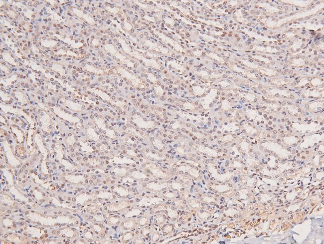 Phospho-JAK3 (Tyr981) Antibody in Immunohistochemistry (Paraffin) (IHC (P))