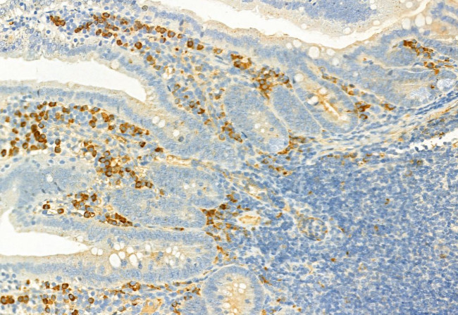 Phospho-LATS1/LATS2 (Ser909, Ser872) Antibody in Immunohistochemistry (Paraffin) (IHC (P))