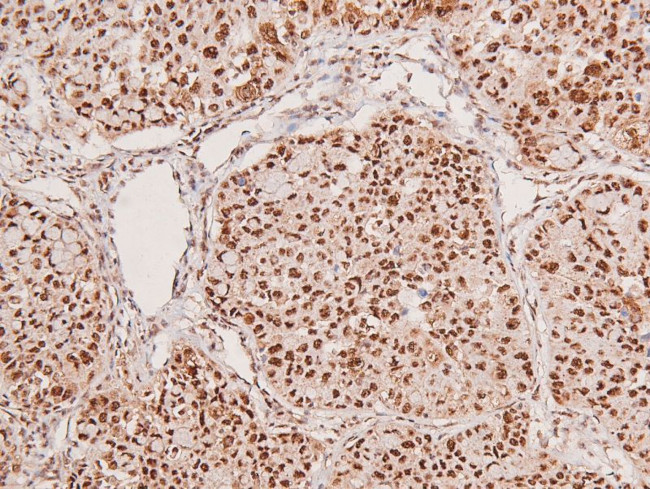 Phospho-LATS1/LATS2 (Ser909, Ser872) Antibody in Immunohistochemistry (Paraffin) (IHC (P))