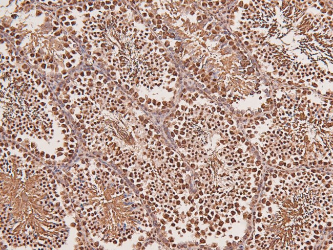 Phospho-LATS1/LATS2 (Ser909, Ser872) Antibody in Immunohistochemistry (Paraffin) (IHC (P))