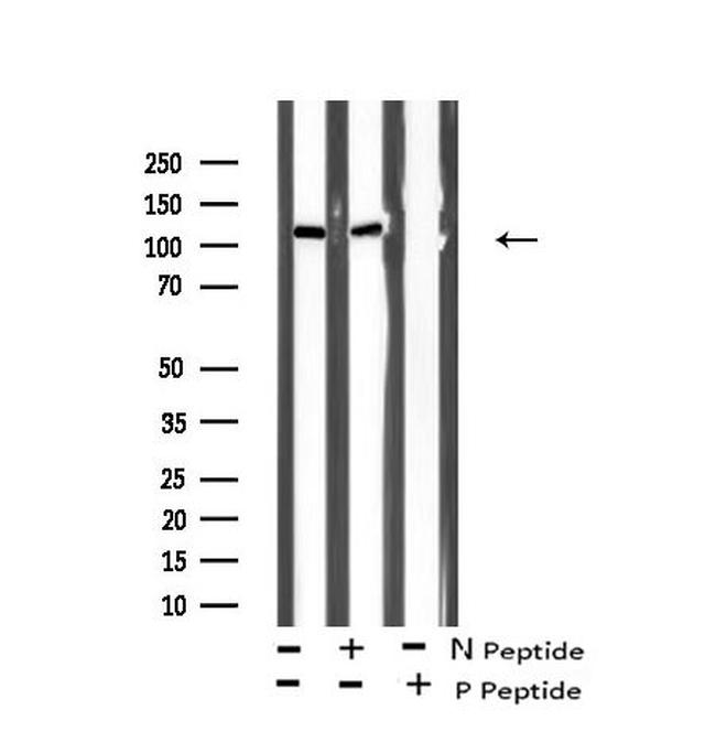 Phospho-LATS1/LATS2 (Ser909, Ser872) Antibody in Western Blot (WB)