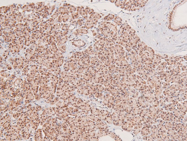 Phospho-MST3 (Thr18) Antibody in Immunohistochemistry (Paraffin) (IHC (P))