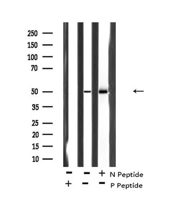 Phospho-MST3 (Thr18) Antibody in Western Blot (WB)