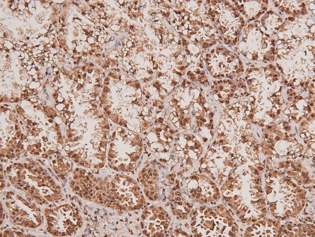 Phospho-ARK5 (Ser600) Antibody in Immunohistochemistry (Paraffin) (IHC (P))