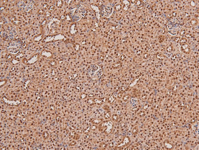 Phospho-ARK5 (Ser600) Antibody in Immunohistochemistry (Paraffin) (IHC (P))