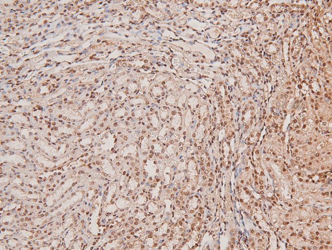 Phospho-ARK5 (Ser600) Antibody in Immunohistochemistry (Paraffin) (IHC (P))