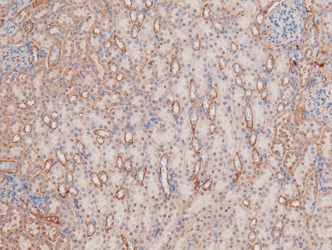 Phospho-p38 MAPK gamma/delta (Tyr185, Tyr182) Antibody in Immunohistochemistry (Paraffin) (IHC (P))