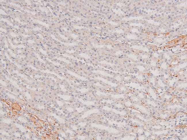 Phospho-p38 MAPK gamma/delta (Tyr185, Tyr182) Antibody in Immunohistochemistry (Paraffin) (IHC (P))