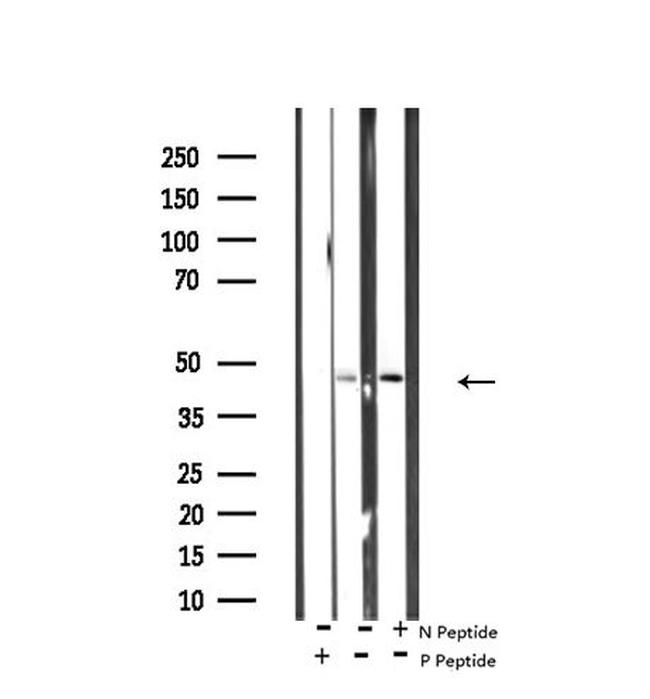 Phospho-p38 MAPK gamma/delta (Tyr185, Tyr182) Antibody in Western Blot (WB)