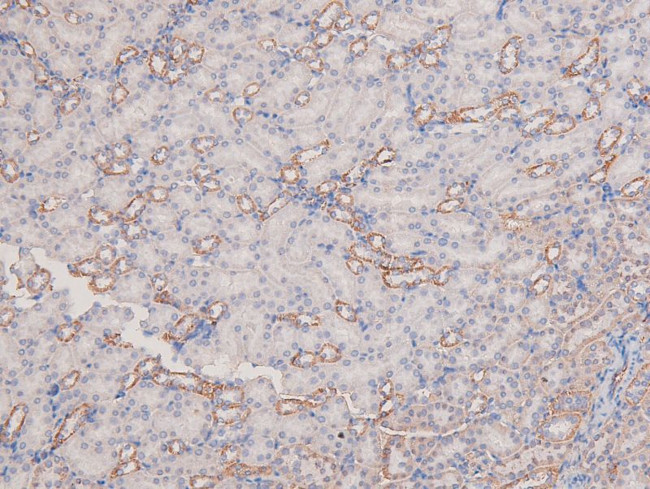 Phospho-PAK1 (Ser21) Antibody in Immunohistochemistry (Paraffin) (IHC (P))