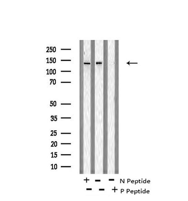Phospho-SIK1/SIK2/SIK3 (Thr182, Thr175, Thr221) Antibody in Western Blot (WB)