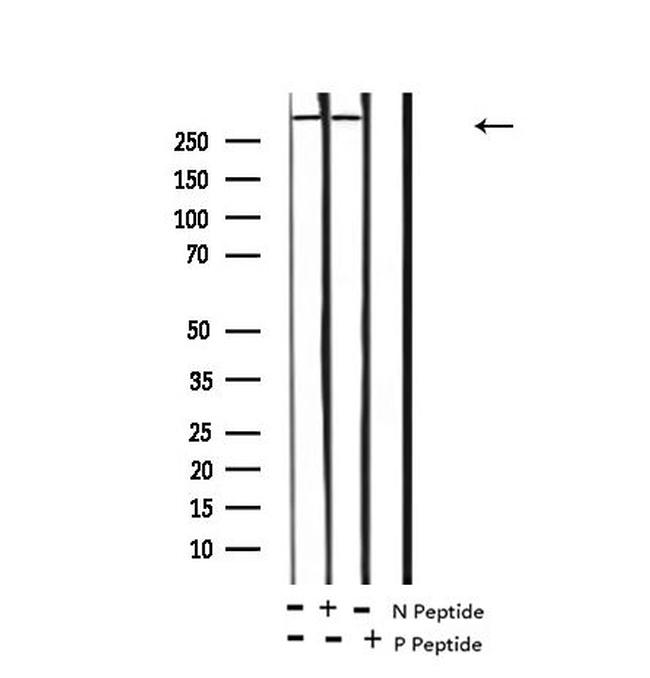 Phospho-ROS1 (Tyr2274) Antibody in Western Blot (WB)