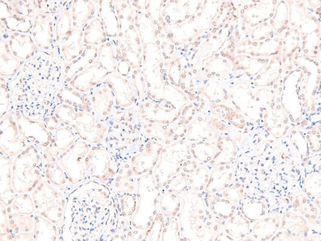 Phospho-RSK3 (Thr356) Antibody in Immunohistochemistry (Paraffin) (IHC (P))