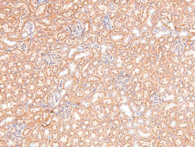 Phospho-RSK3 (Thr356) Antibody in Immunohistochemistry (Paraffin) (IHC (P))