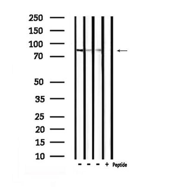 Phospho-RSK3 (Thr356) Antibody in Western Blot (WB)