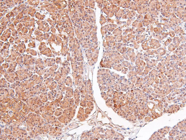 Phospho-RSK3 (Ser360) Antibody in Immunohistochemistry (Paraffin) (IHC (P))