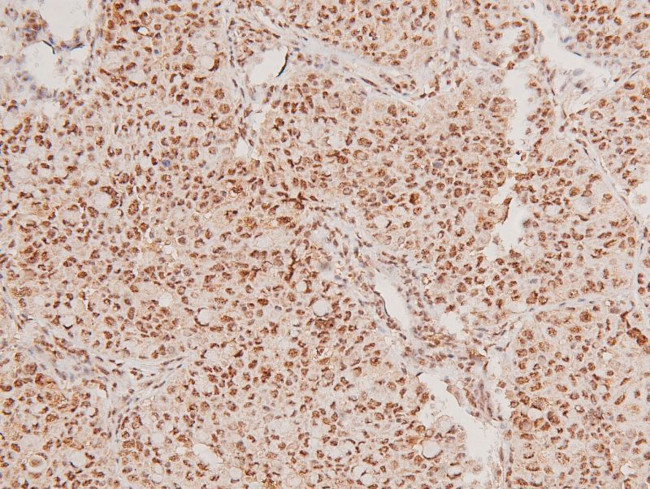 Phospho-SIK1 (Thr182) Antibody in Immunohistochemistry (Paraffin) (IHC (P))