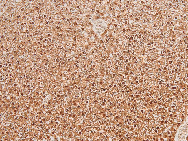 Phospho-SIK1 (Thr182) Antibody in Immunohistochemistry (Paraffin) (IHC (P))