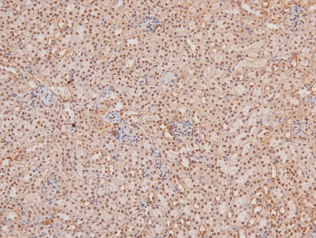 Phospho-TBK1 (Ser172) Antibody in Immunohistochemistry (Paraffin) (IHC (P))