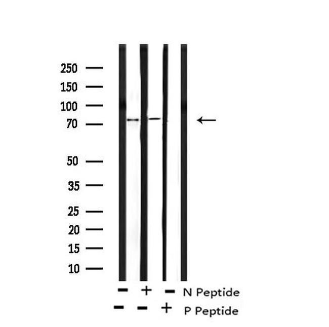 Phospho-TBK1 (Ser172) Antibody in Western Blot (WB)