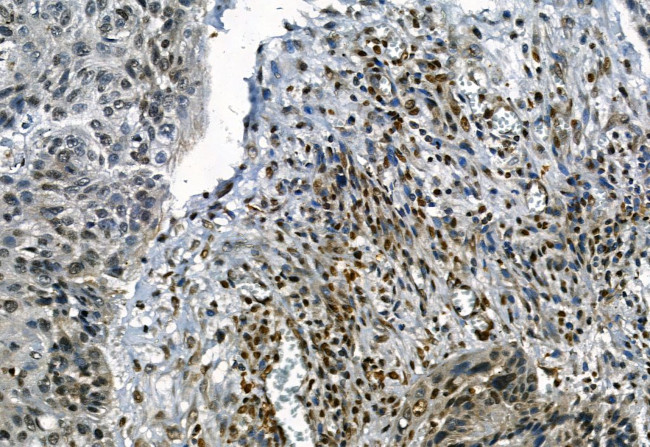 Phospho-TBK1 (Ser172) Antibody in Immunohistochemistry (Paraffin) (IHC (P))