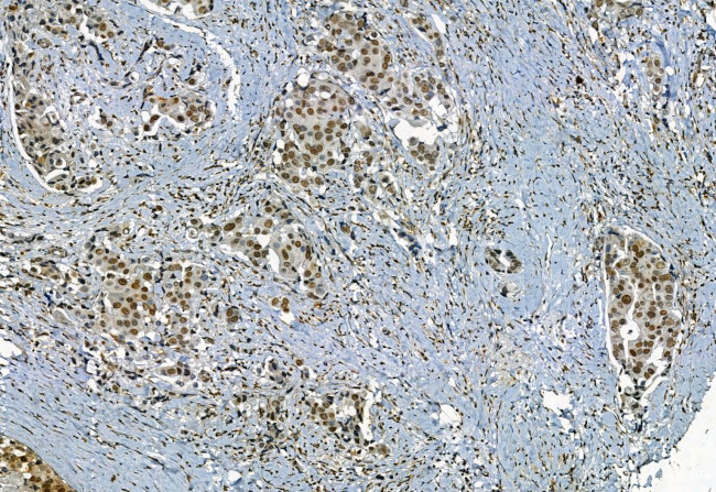 Phospho-TBK1 (Ser172) Antibody in Immunohistochemistry (Paraffin) (IHC (P))