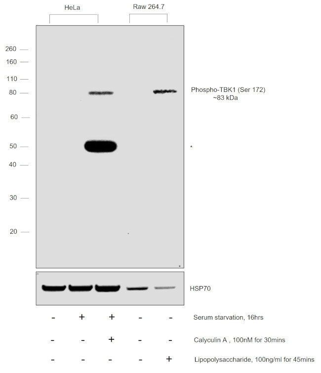 Phospho-TBK1 (Ser172) Antibody