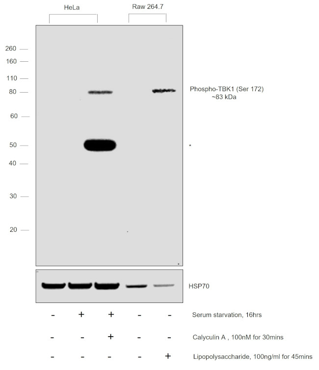 Phospho-TBK1 (Ser172) Antibody in Western Blot (WB)