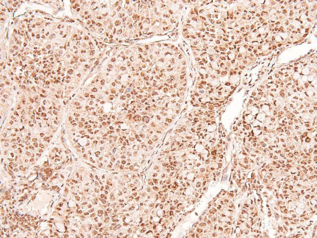 Phospho-TGFBR2 (Tyr284) Antibody in Immunohistochemistry (Paraffin) (IHC (P))