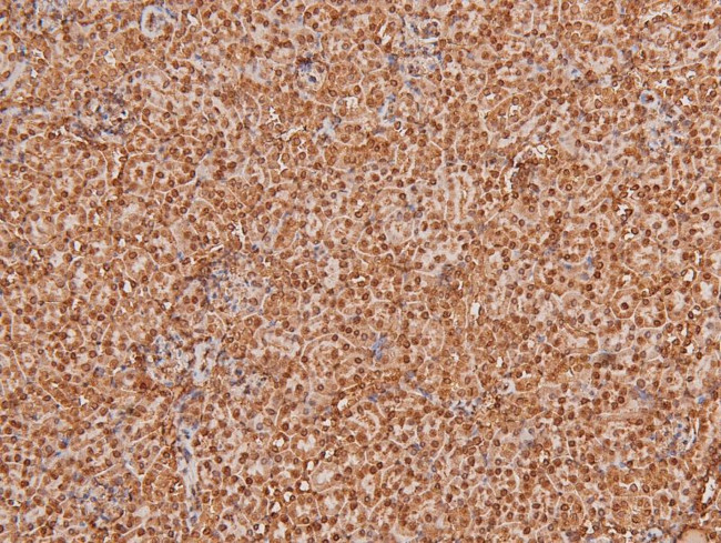 Phospho-TGFBR2 (Tyr284) Antibody in Immunohistochemistry (Paraffin) (IHC (P))