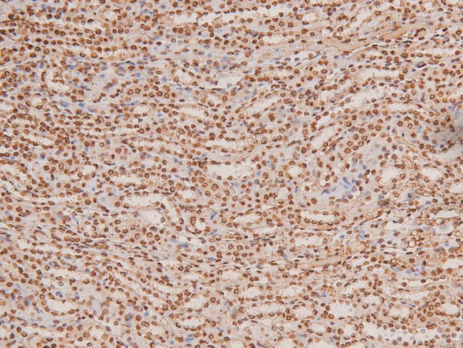 Phospho-TGFBR2 (Tyr284) Antibody in Immunohistochemistry (Paraffin) (IHC (P))