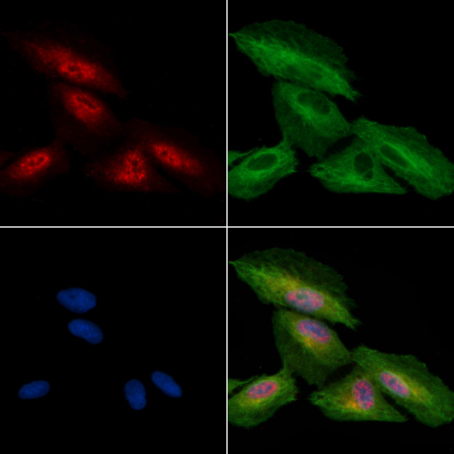 Phospho-ZAK (Ser165) Antibody in Immunocytochemistry (ICC/IF)