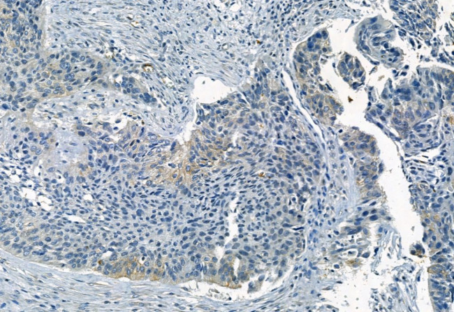 Phospho-FRS2 (Tyr196) Antibody in Immunohistochemistry (Paraffin) (IHC (P))