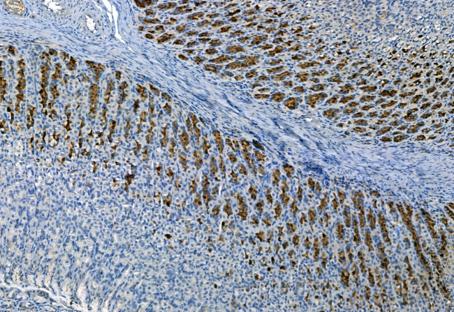 Phospho-FRS2 (Tyr196) Antibody in Immunohistochemistry (Paraffin) (IHC (P))