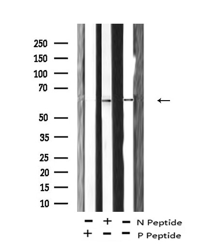 Phospho-FRS2 (Tyr196) Antibody in Western Blot (WB)