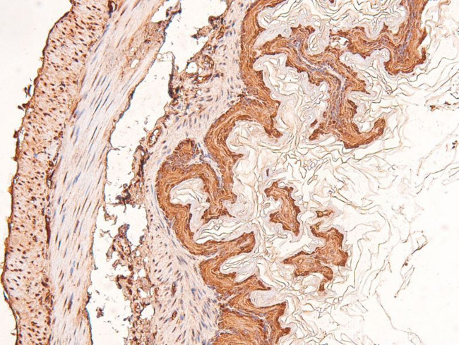 Phospho-FRS2 (Tyr196) Antibody in Immunohistochemistry (Paraffin) (IHC (P))