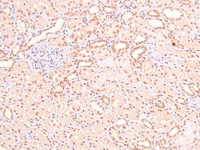 Phospho-LAT (Tyr161) Antibody in Immunohistochemistry (Paraffin) (IHC (P))