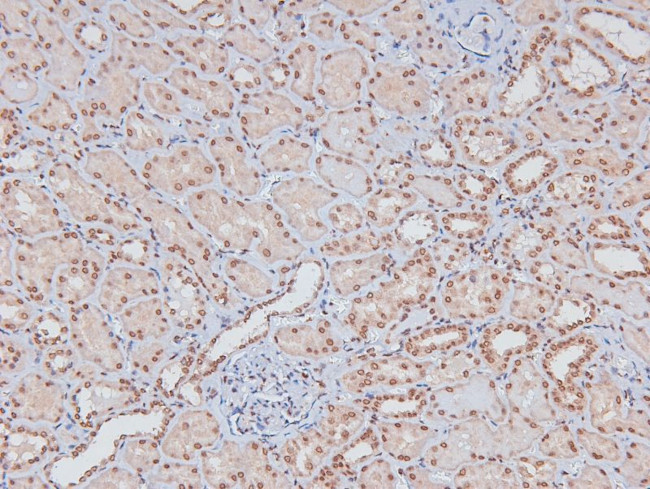 Phospho-LAT (Tyr161) Antibody in Immunohistochemistry (Paraffin) (IHC (P))