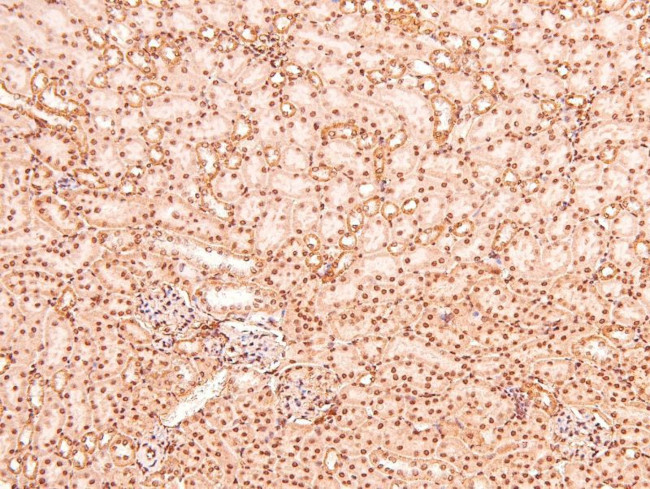 Phospho-LAT (Tyr161) Antibody in Immunohistochemistry (Paraffin) (IHC (P))