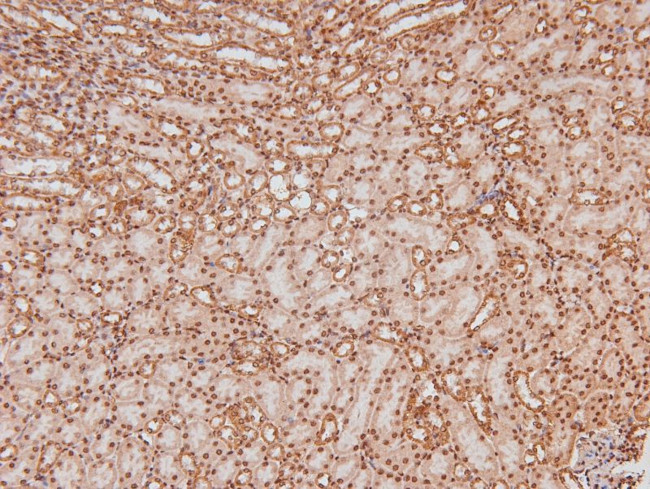 Phospho-LAT (Tyr161) Antibody in Immunohistochemistry (Paraffin) (IHC (P))