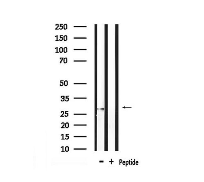 Phospho-LAT (Tyr161) Antibody in Western Blot (WB)