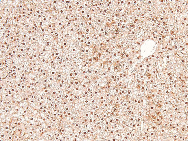 Phospho-RET (Tyr1015) Antibody in Immunohistochemistry (Paraffin) (IHC (P))