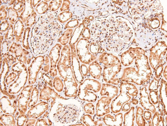 Phospho-BRCA1 (Ser1387) Antibody in Immunohistochemistry (Paraffin) (IHC (P))