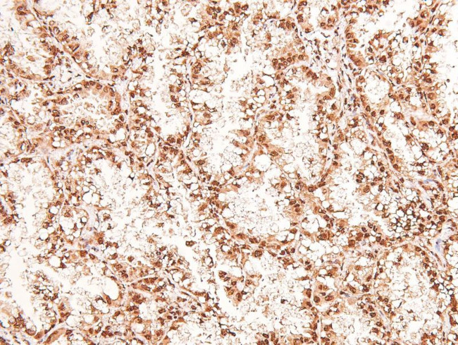 Phospho-eIF2b epsilon (Ser540) Antibody in Immunohistochemistry (Paraffin) (IHC (P))