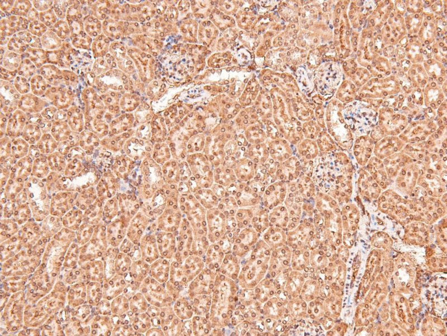 Phospho-eIF2b epsilon (Ser540) Antibody in Immunohistochemistry (Paraffin) (IHC (P))