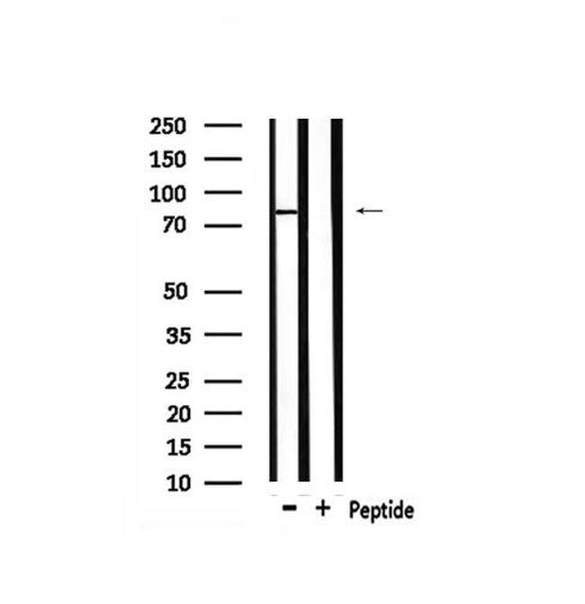 Phospho-eIF2b epsilon (Ser540) Antibody in Western Blot (WB)